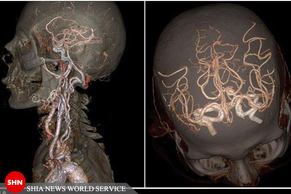 تصاویر/مغز، استخوان و عروق به شکلی که تاکنون ندیده‌اید
