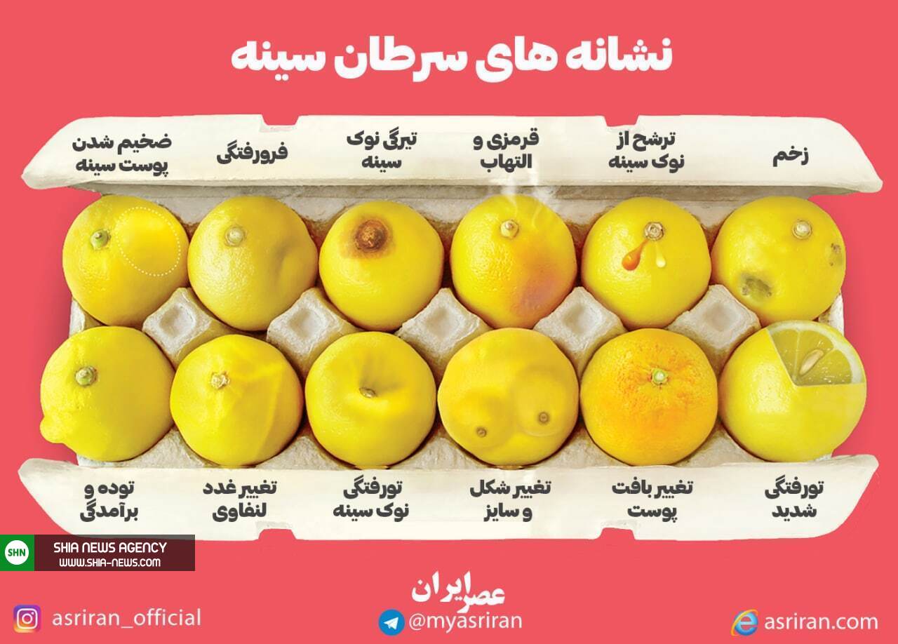 اینفوگرافیک/ نشانه های سرطان سینه