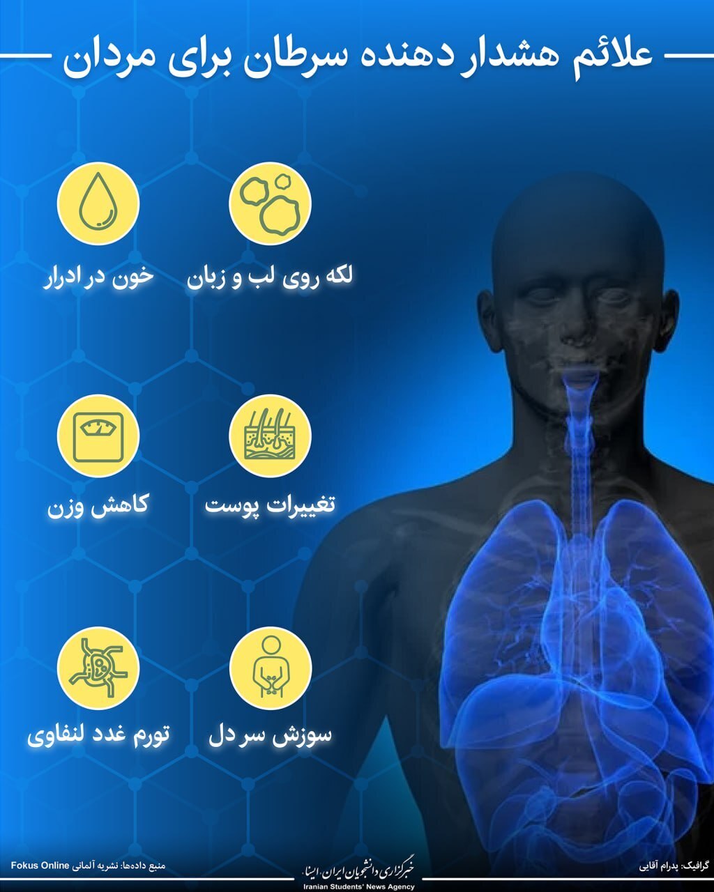 اینفوگرافیک/ علائم هشداردهنده سرطان برای مردان