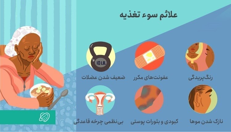 اینفوگرافی/ علائم سوتغذیه چیست؟